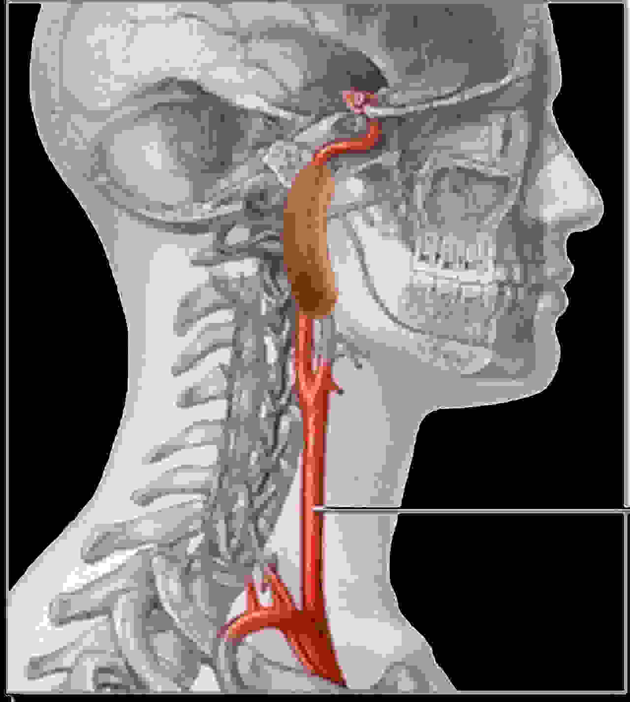 A VIEW OF THE CAROTID ARTERY INSIDE THE NECK & SKULL W/ A SAUSAGE PORTION OF IT